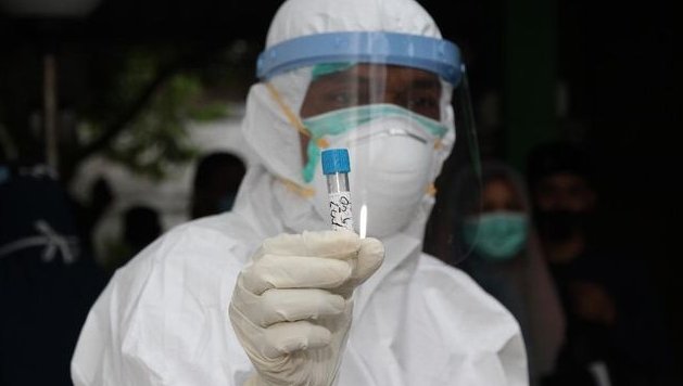 Pengendara Menuju Berastagi Bakal Dites Antigen-Urine